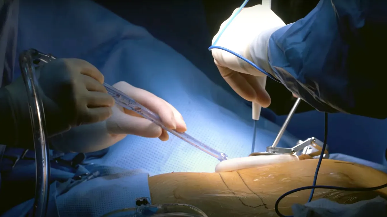 Dr. Codin Saon prezentand servicii de chirurgie toracica
